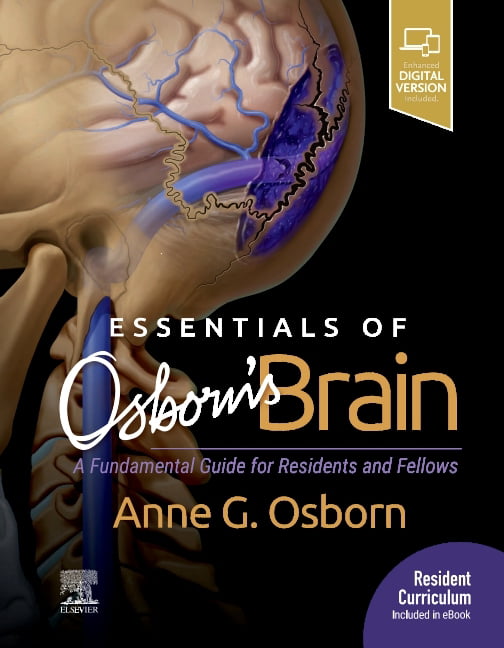 Essentials of Osborn's Brain by Anne G. Osborn - 9780323713207
