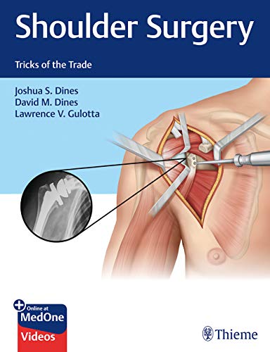 Shoulder Surgery - 9781626235168