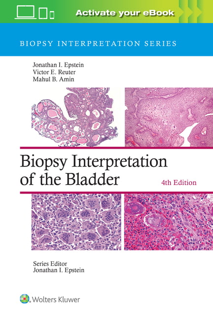 Biopsy Interpretation of the Bladder: Print + ---- with Mult... - 9781975199203