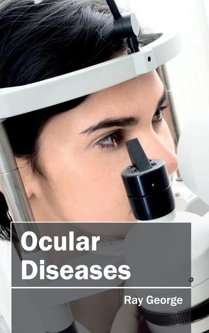 George - Ocular Diseases - New hardback or cased book - X555z
