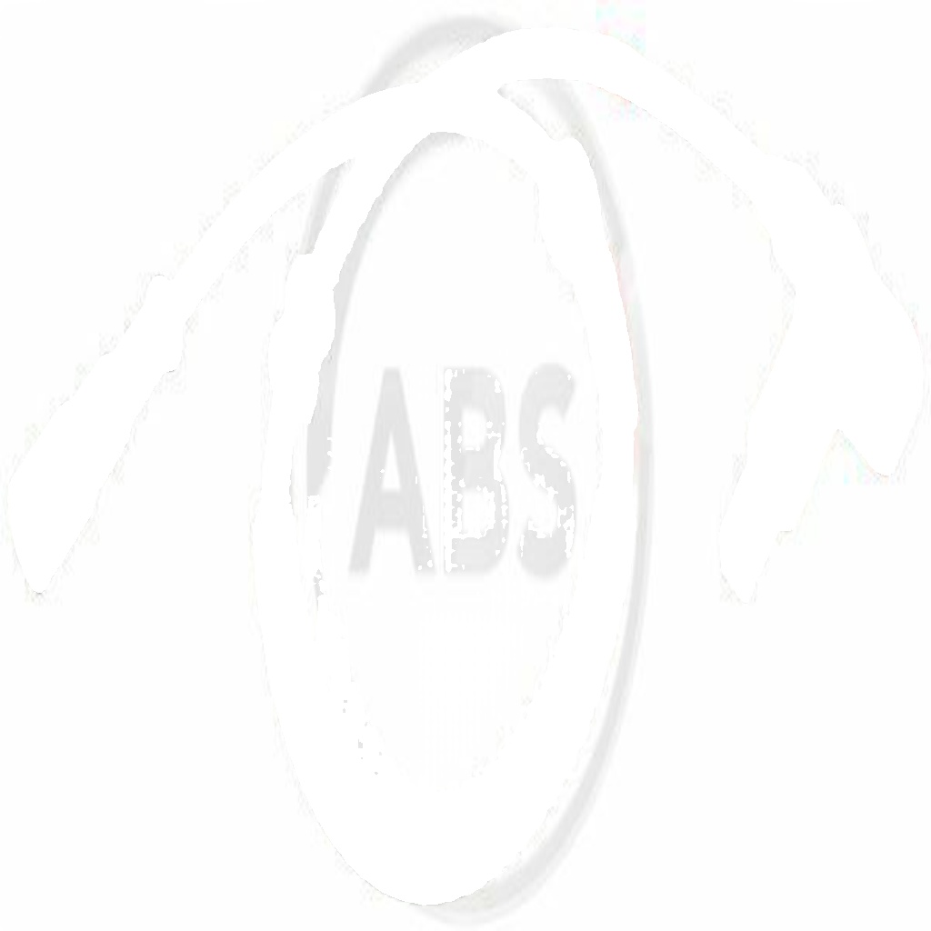 30423 A.B.S. Sensor, wheel speed for RENAULT