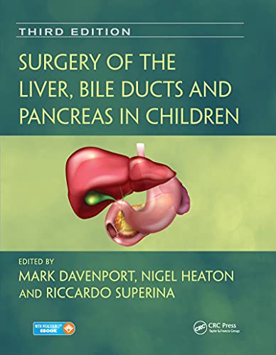 Surgery of the Liver, Bile Ducts and Pancreas in Children by ... - 9780367573492