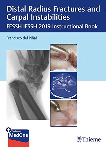 Distal Radius Fractures and Carpal Instabilities - 9783132423794