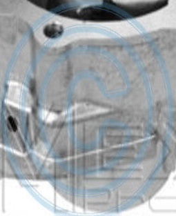 MEYLE 34-13 220 0003 Water Pump for SUBARU