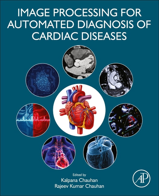 Image Processing for Automated Diagnosis of Cardiac Diseases - 9780323850643