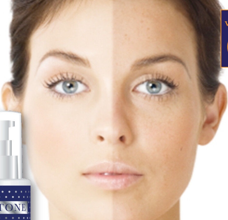 FAIRTONE WHITENIZER CREAM-GEL WITH VITAMIN C STOP PIGMENTATION & CHLOASMA