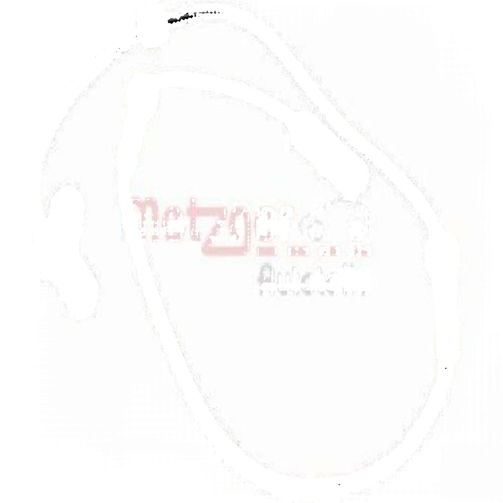 ✅Fits METZGER 09001292 SENSOR, WHEEL SPEED  ⭐UK Seller⭐