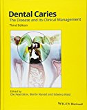 Dental Caries : The Disease and Its Clinical Management by Bente Nyvad (2015,...