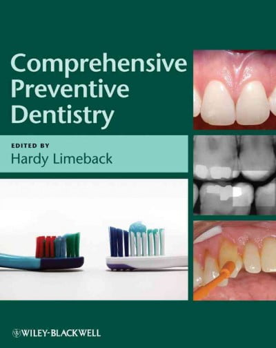 Comprehensive Preventive Dentistry by Hardy Limeback - 9780813821689