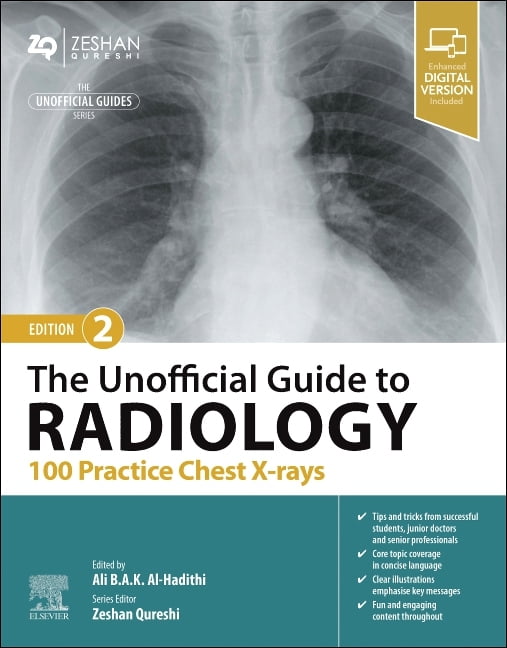 The Unofficial Guide to Radiology: 100 Practice Chest X-rays