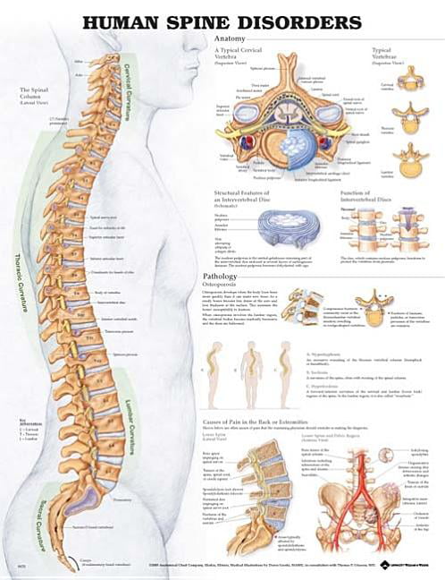 Human Spine Disorders Anatomical Chart by Anatomical Chart Company Staff ... - Image 4