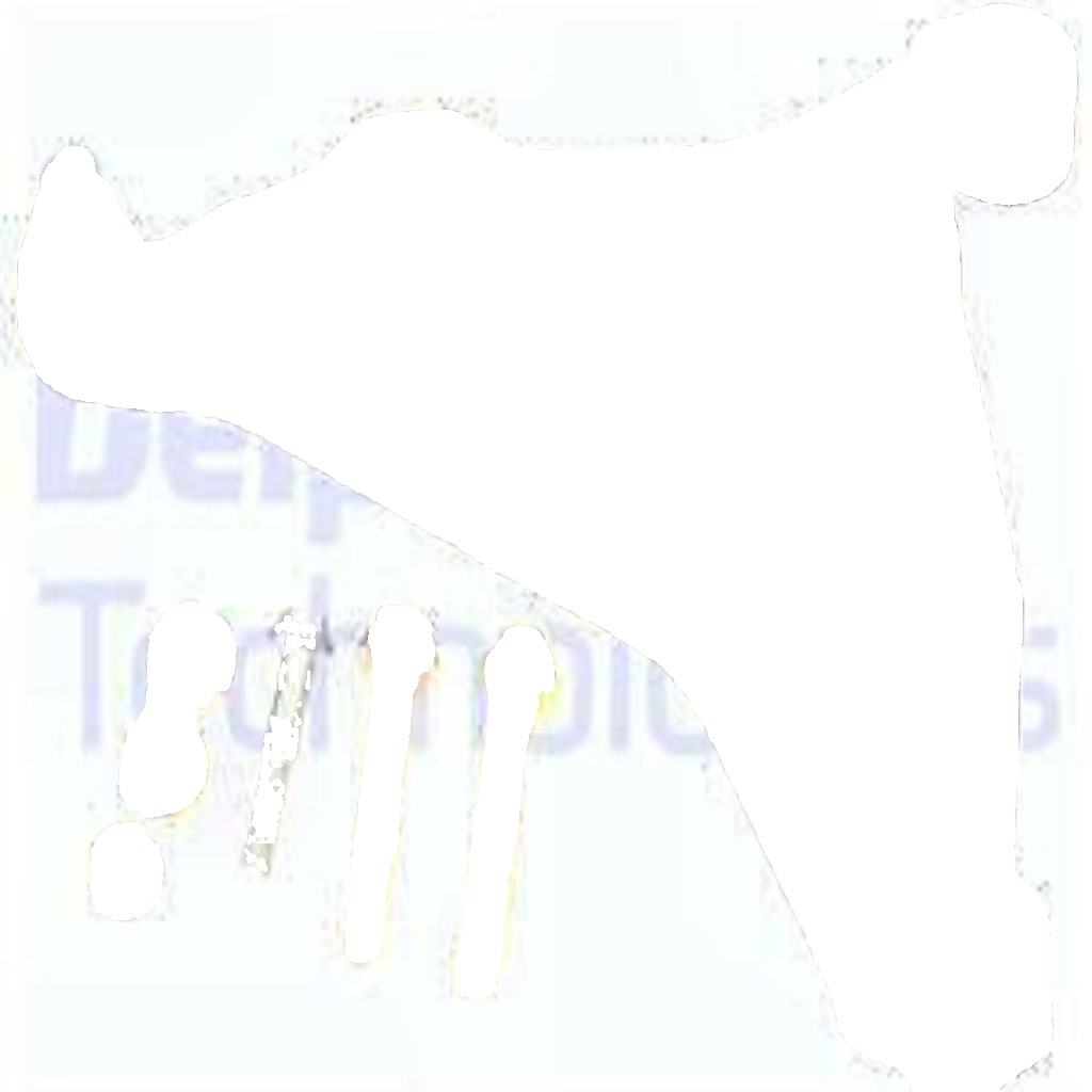 TC876 DELPHI Track Control Arm for VOLVO