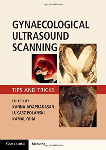 Gynaecological Ultrasound Scanning