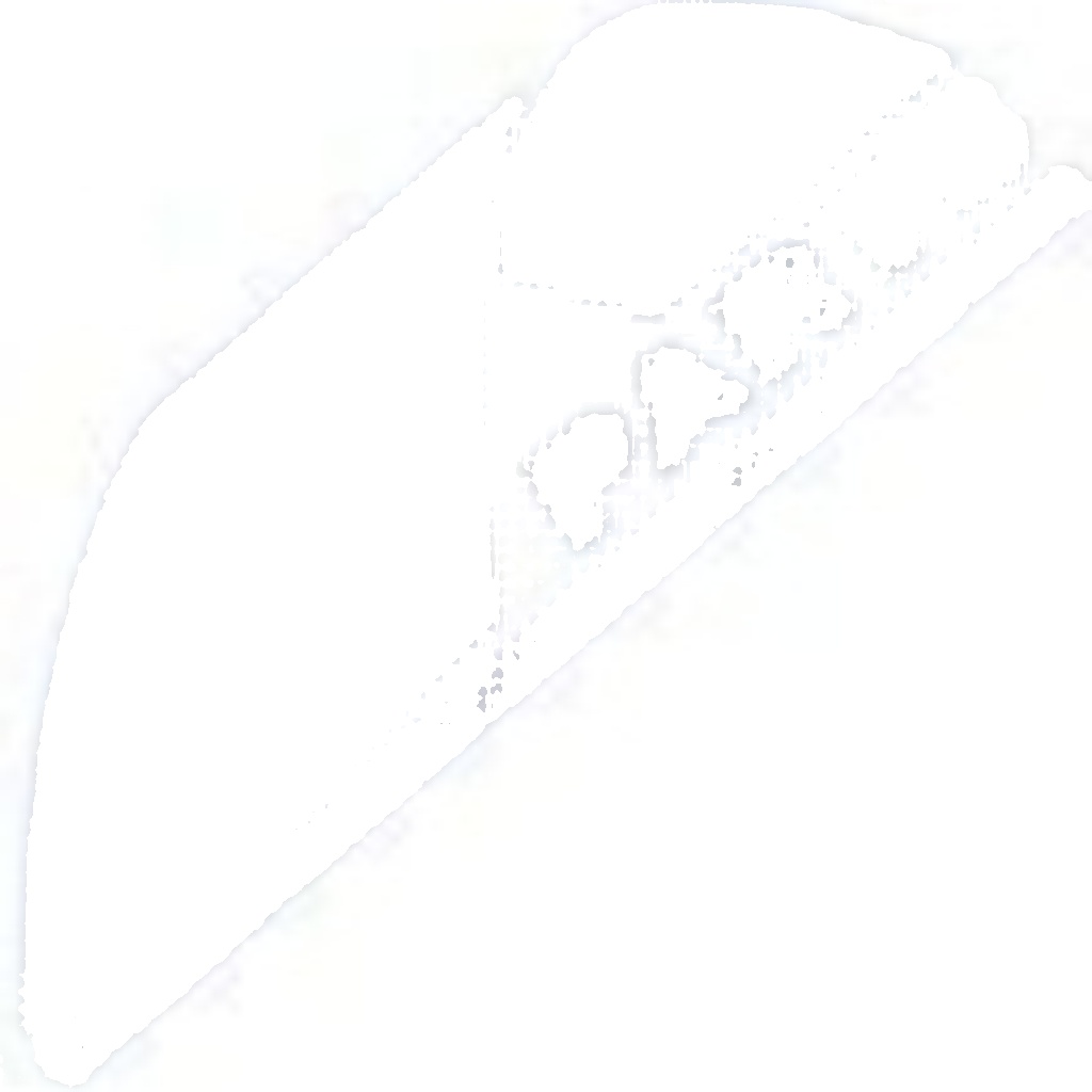 EGT-ME-038 NTY Sensor, exhaust gas temperature for SMART