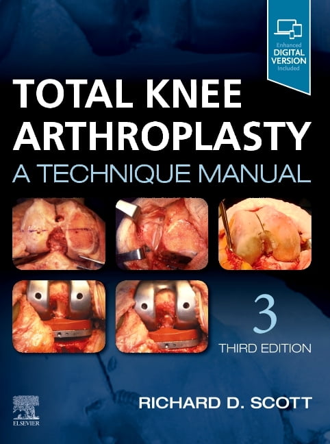 Total Knee Arthroplasty by Richard D. Scott - 9780323710657