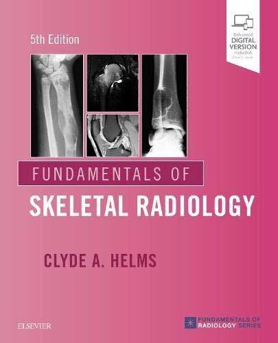 Fundamentals of Skeletal Radiology by Clyde A. Helms - 9780323611657
