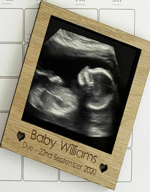 Pregnancy Announcement Magnetic Polaroid Frame Scan Baby Picture Grandparents