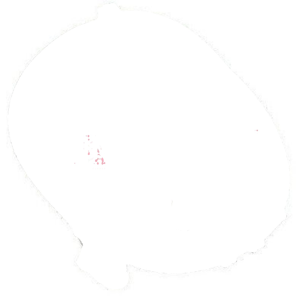 Front Right AUTLOG AS4349 Sensor, wheel speed for TOYOTA