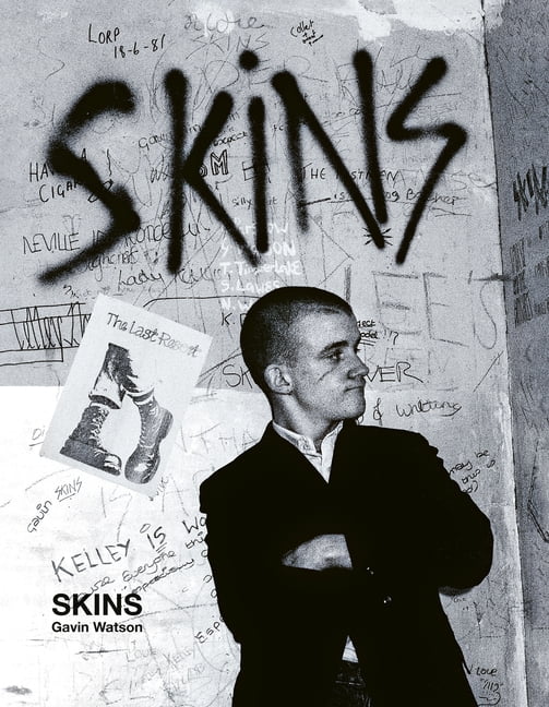 Skins Gavin Watson by Gavin Watson (Hardback Book) - Image 3