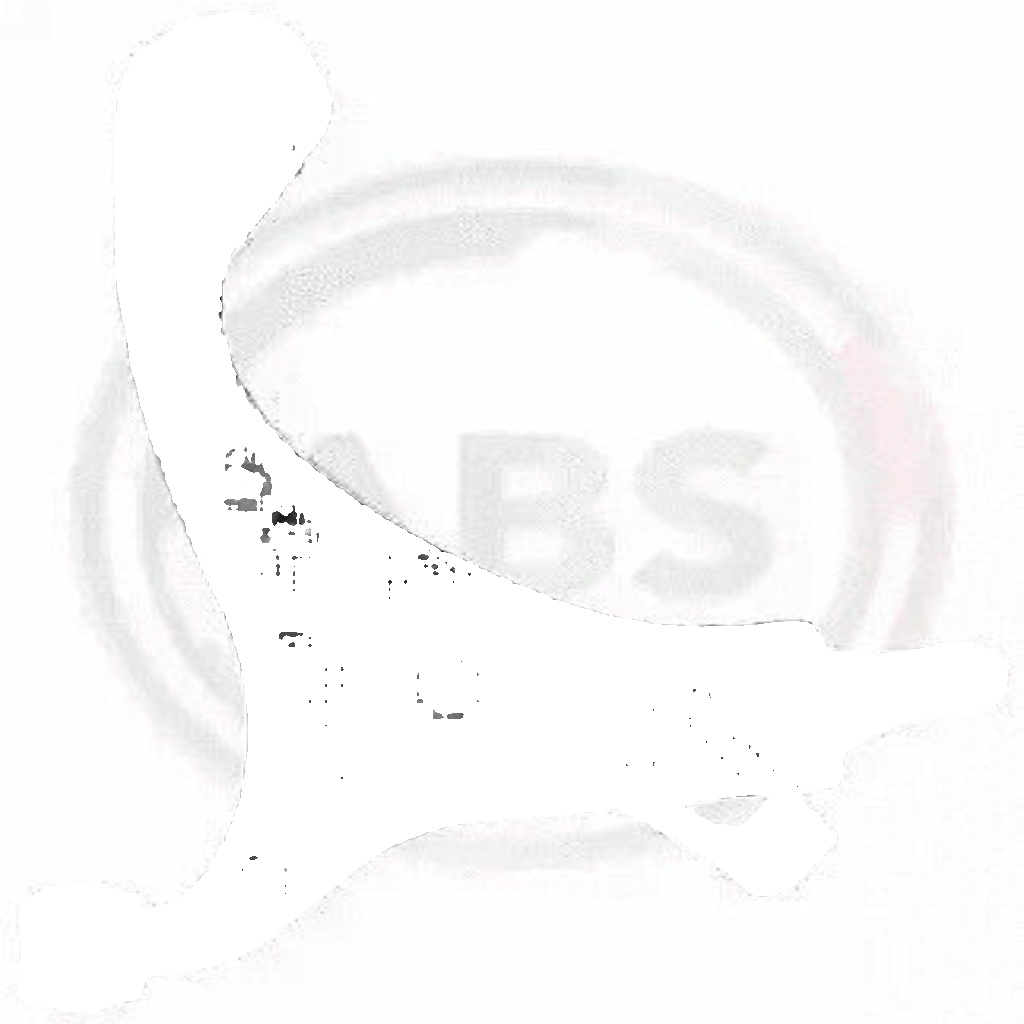 211458 A.B.S. Track Control Arm for KIA