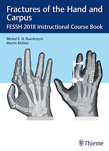 Fractures of the Hand and Carpus – FESSH 2018 Instructional Course Book Hardback