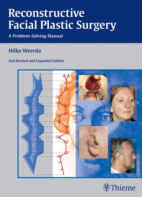 Reconstructive Facial Plastic Surgery by Hilko Weerda - 9783131296429