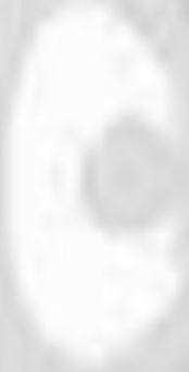 Transmission End SASIC 2873803 Bellow Set, drive shaft for CITROËN,PEUGEOT
