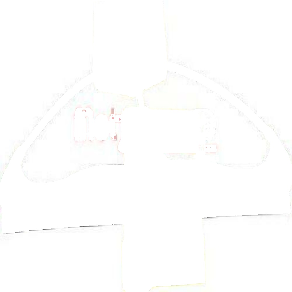 Original METZGER Window Regulator 2160330 For Audi