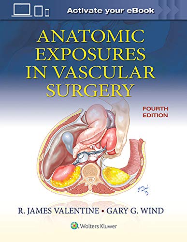 Anatomic Exposures in Vascular Surgery by R. James Valentine,... - 9781975152765