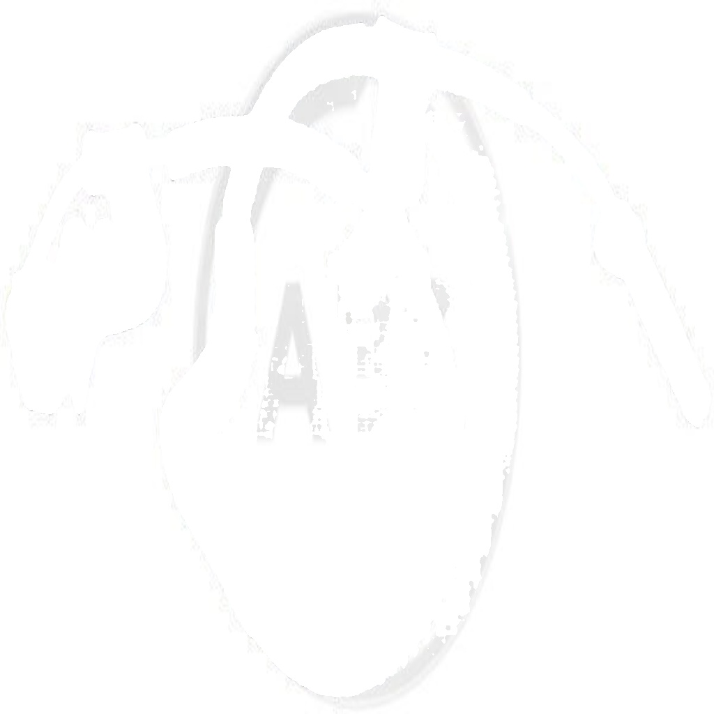 30900 A.B.S. Sensor, wheel speed for KIA