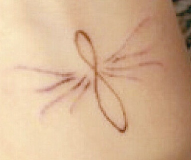 INKED UP TATTOO FADING OIL – REMOVE TATTOO GET RID OF INK CLEAR SKIN FAST WORK