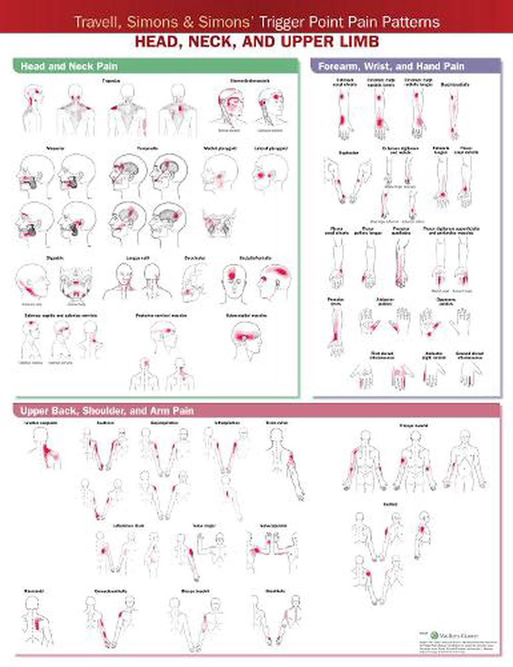 Travell, Simons & Simons’ Trigger Point Pain Patterns Wall  POSTER / WALLCHART - Image 4