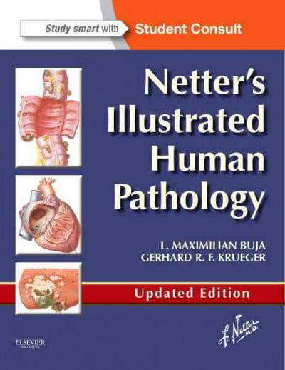 Netters Illustrated Human Pathology Updated by Gerhard R. F.  Krueger PAPERBACK - Image 6