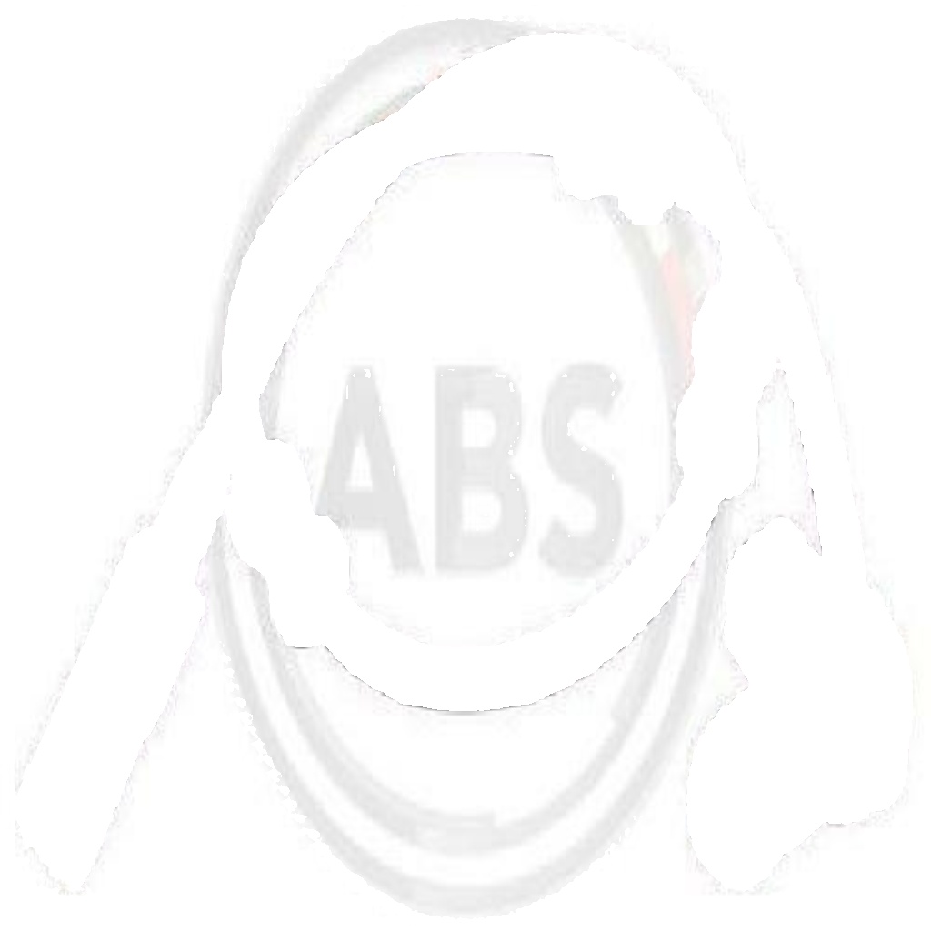 30246 A.B.S. Sensor, wheel speed for MERCEDES-BENZ
