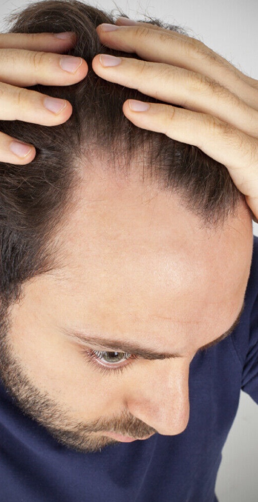 PRO-GROWTH MENS HAIR GROW CAPSULES HAIR GROWTH TABLETS STOP HAIR LOSS BALD